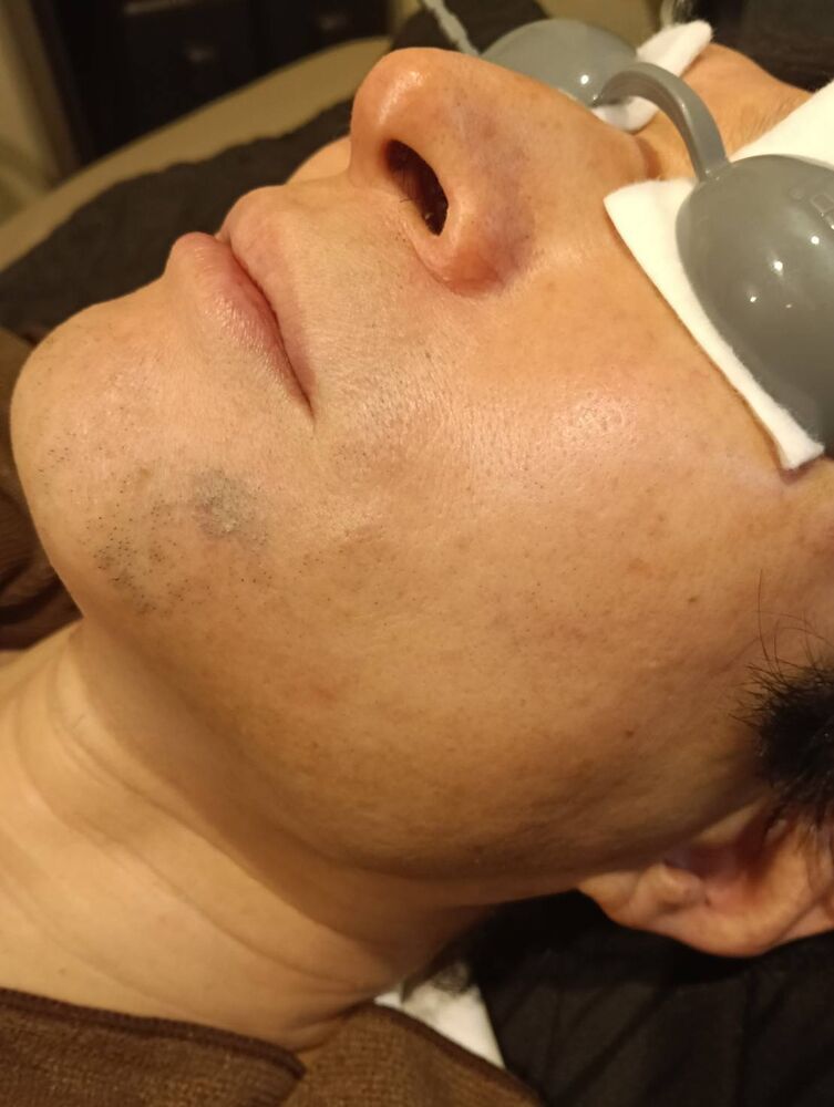 画像10425