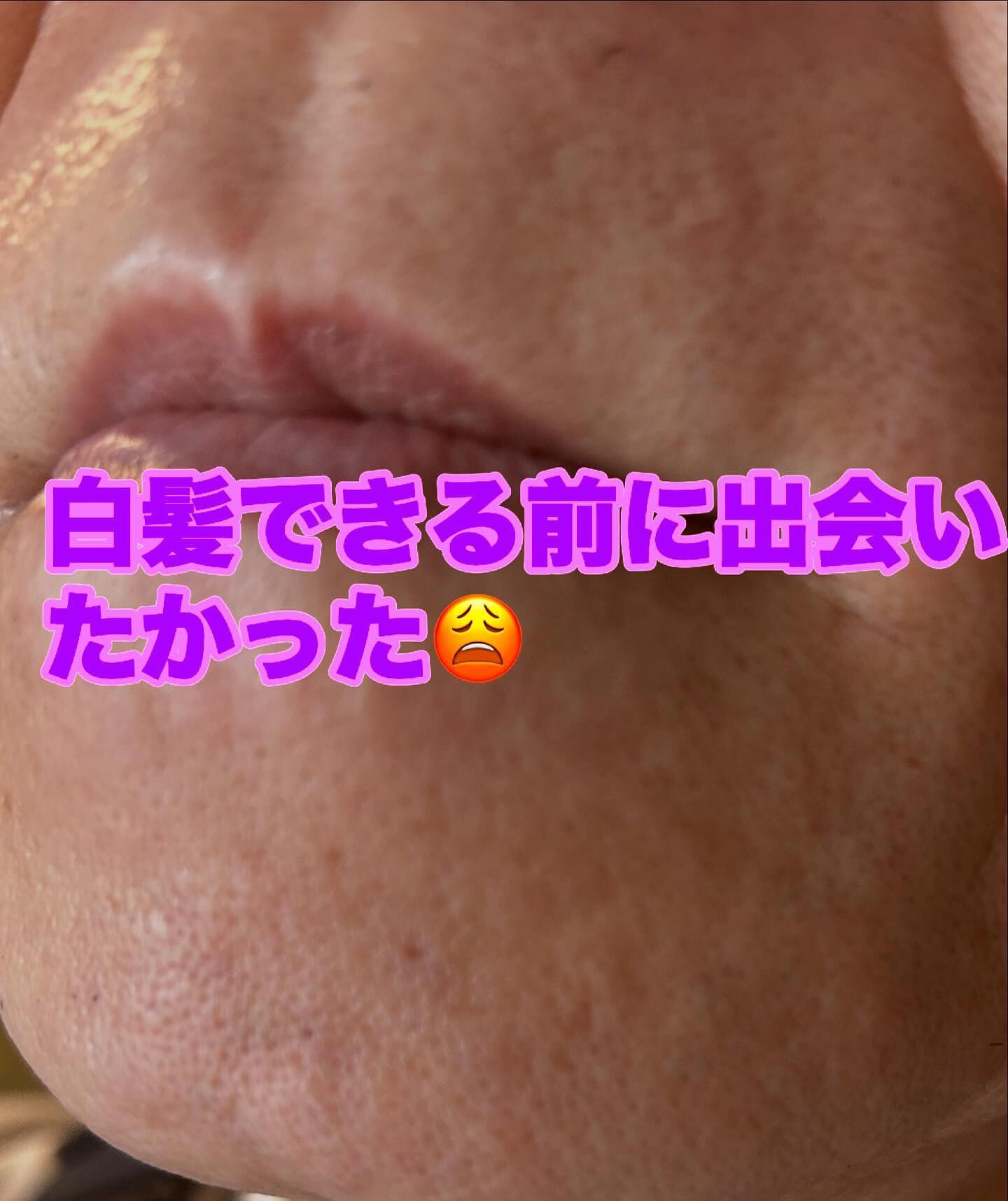 白髪混じりの黒いヒゲにお悩みの男性のお客様、こんにちは！👋 