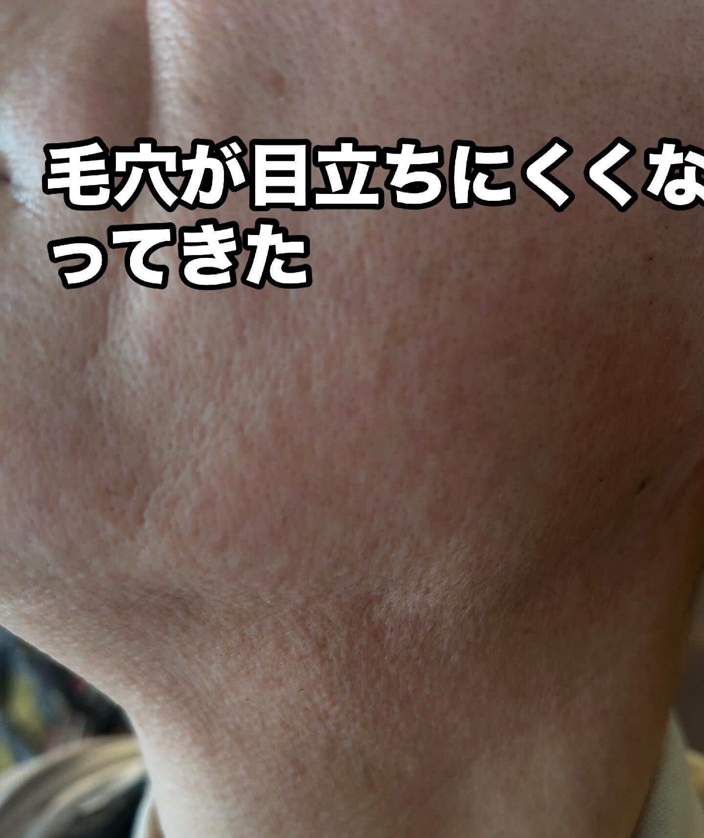 白髪混じりの黒いヒゲにお悩みの男性のお客様、こんにちは！👋 