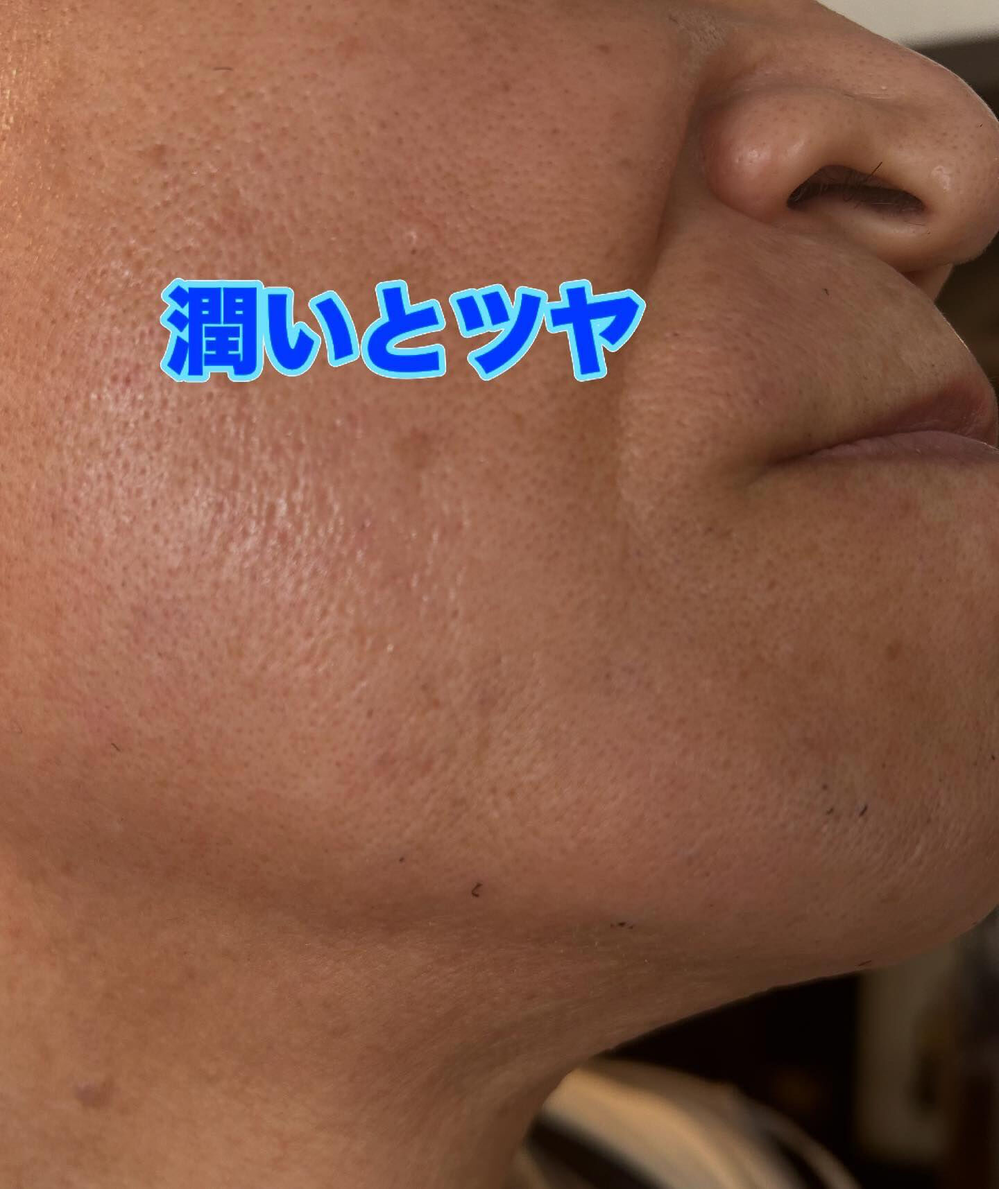 白髪混じりの黒いヒゲにお悩みの男性のお客様、こんにちは！👋 