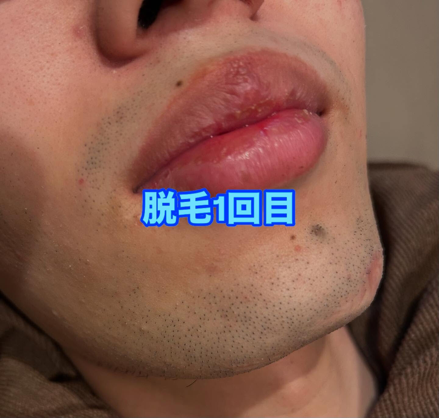 🌟こんにちは、皆様！こちらはサロン【美肌サロン】の投稿です😊