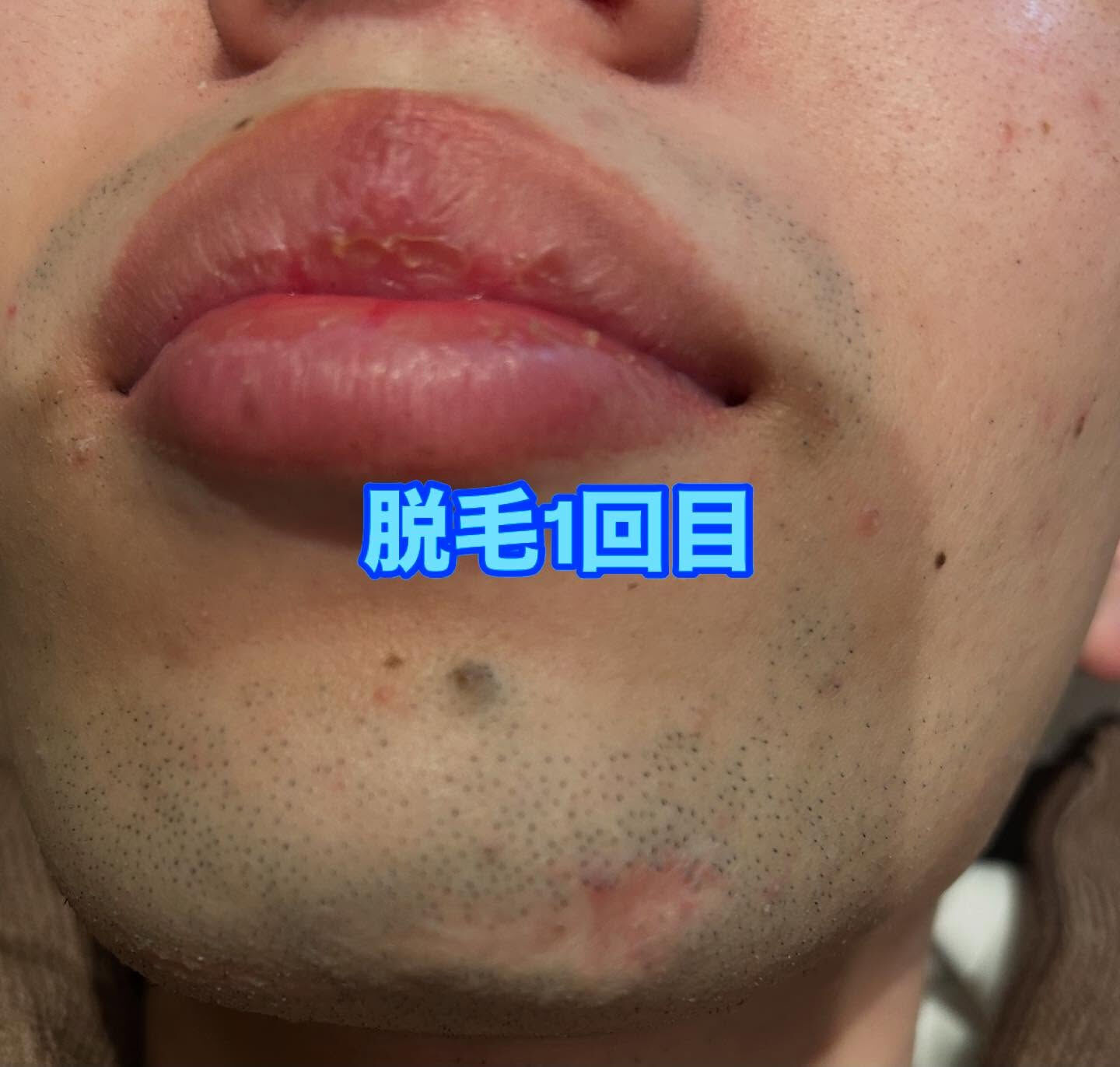 🌟こんにちは、皆様！こちらはサロン【美肌サロン】の投稿です😊