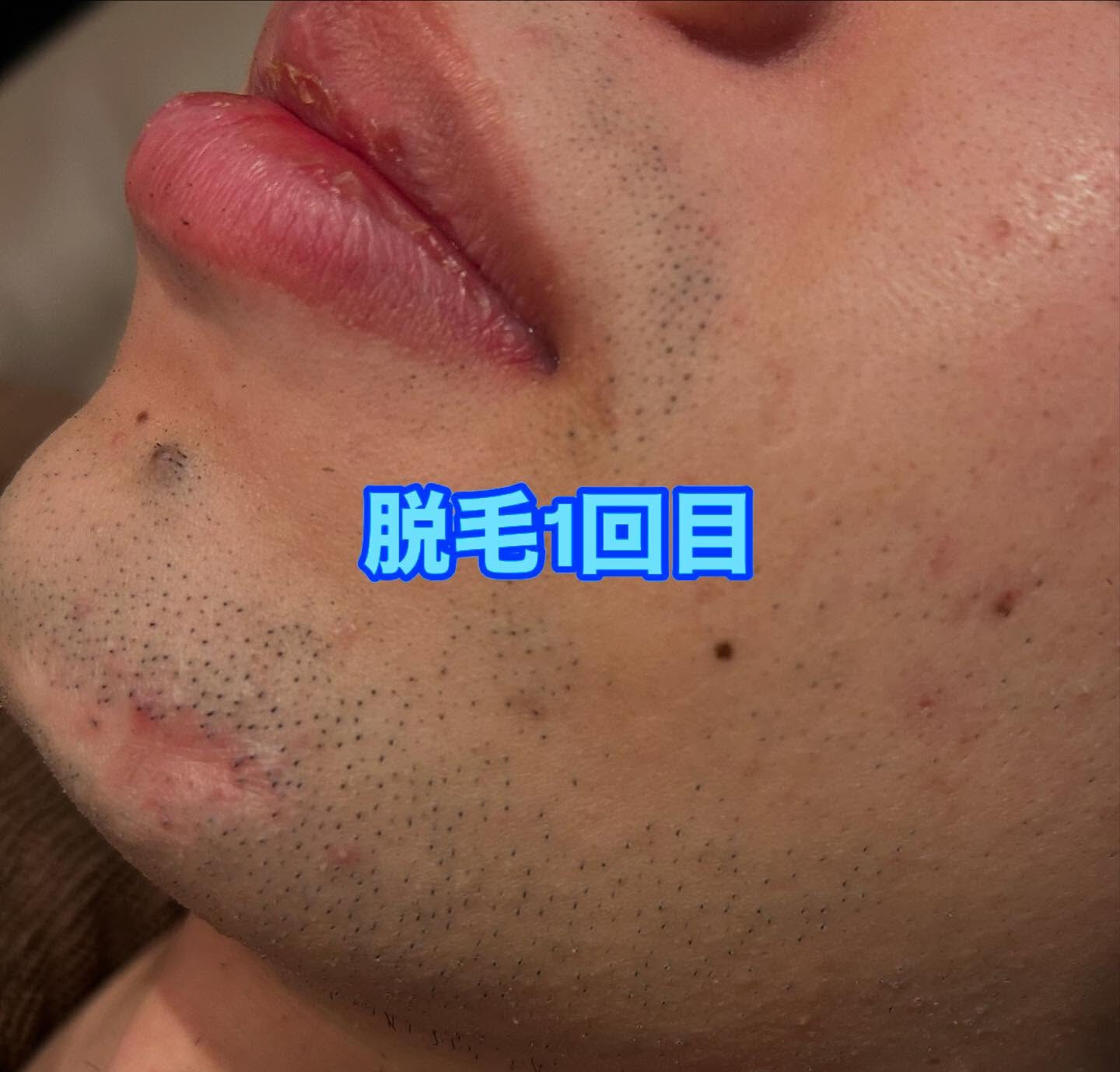 🌟こんにちは、皆様！こちらはサロン【美肌サロン】の投稿です😊