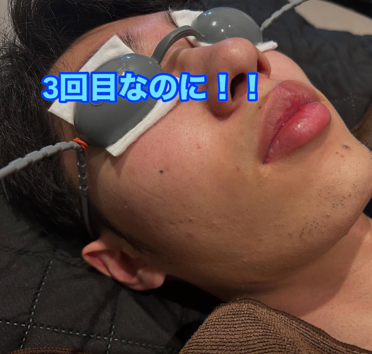 🌟こんにちは、皆様！こちらはサロン【美肌サロン】の投稿です😊