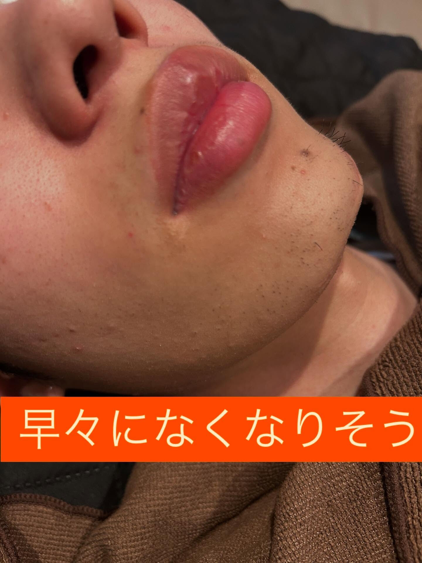 ❗️初めての方も大歓迎❗️光脱毛のワンダフルな効果を体験しま