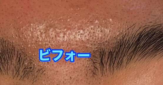 お手入れが楽になります！💫眉毛ブローで、毎朝のルーティンがも