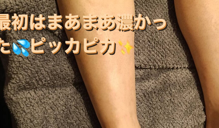 ✨最近、男性の皆様も足の脱毛に興味を持っている方が増えていま