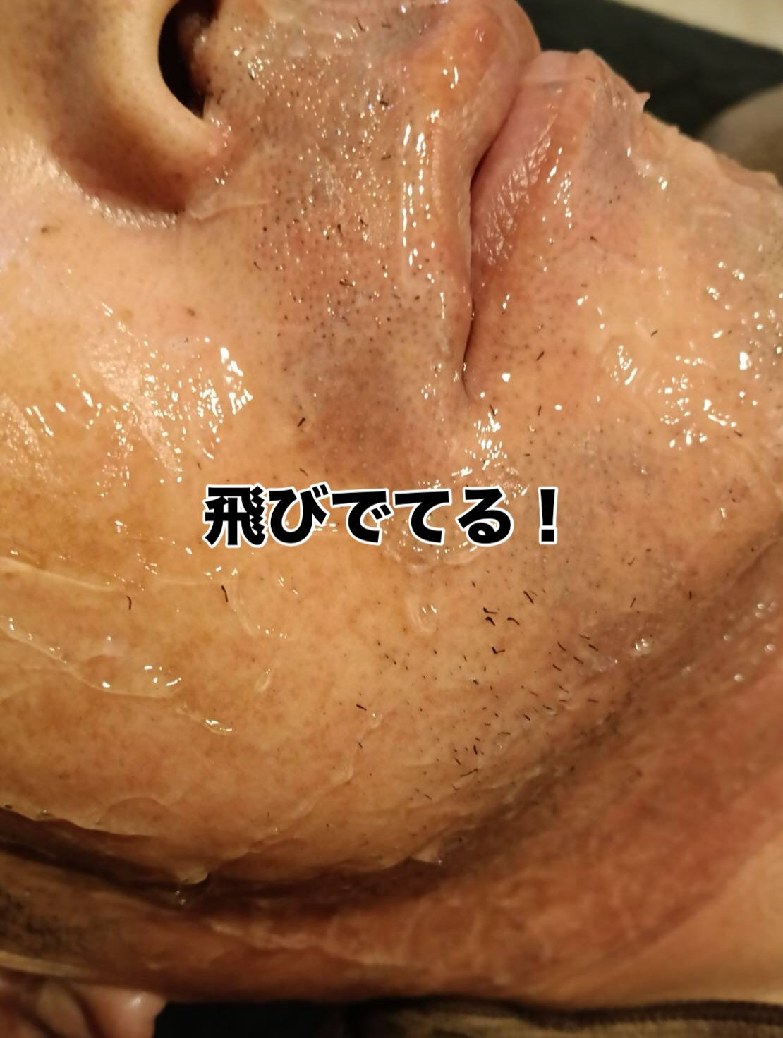 🌟こんにちは、皆様！脱毛が気になる季節がやってきましたね！✨
