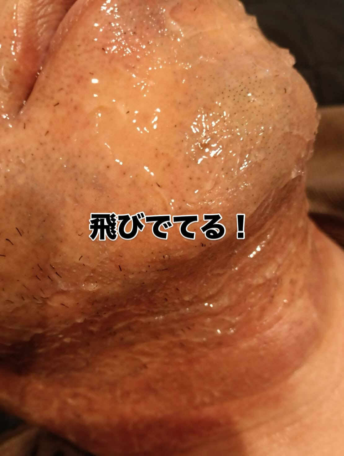 🌟こんにちは、皆様！脱毛が気になる季節がやってきましたね！✨
