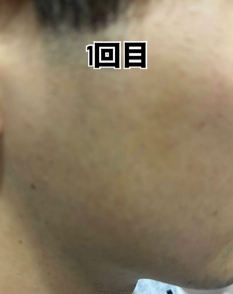 画像8964